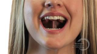 Myofunctional Therapy | Tongue Click and Smile