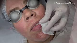 Rejuvenescimento 7D