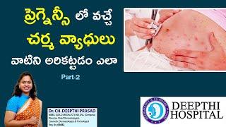 Pregnancy and Skin Problems | Dr Deepthi Prasad | Dermatologist | Karimnagar