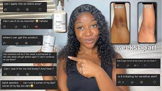 HOW TO USE GLYCOLIC ACID TONER FOR THE BEST RESULTS | answering your questions