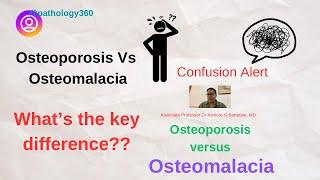 Osteoporosis Vs Osteomalacia : explained with examples;  what is the key difference? #medicos #md