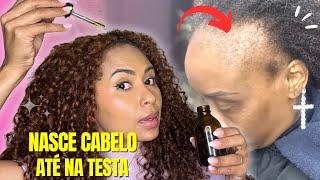 APENAS TRÊS INGREDIENTES O CABELO CRESCE MUITO E NÃO CAI| NÃO USE MUITO!