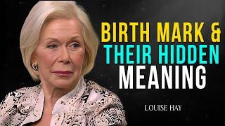 Louise Hay: The Hidden Spiritual Meaning of Your Birthmark Revealed!