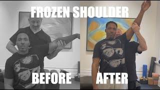 FIREFIGHTER WITH DOUBLE FROZEN SHOULDER???   *MUST SEE RESULTS!*