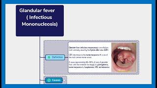 INFECTIOUS MONONUCLEOSIS ( Glandular Fever ) : Symptoms, Diagnosis, Management