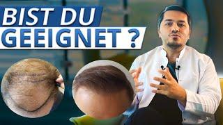 Haartransplantation: bist du geeignet?