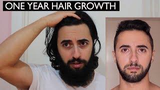 GROWING HAIR ONE YEAR | MY EXPERIENCE & TIPS | Harry Ax