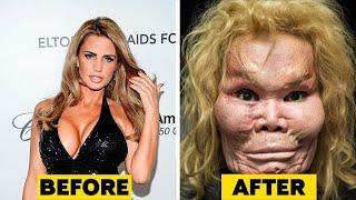 GRABE TO! 20 SIKAT NA CELEBRITIES NA NASIRA ANG MUKA DAHIL SA PLASTIC SURGERY!