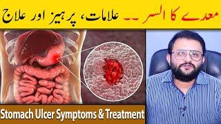 Stomach Ulcer Symptoms & Treatment - Stomach Ulcer Ka Ilaj - Maidey Ka Ulcer - Dr Raja Omer Fiaz