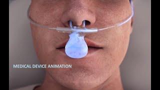 Medical Device Animation by Arcreative Media (3D Medical Device Animation)