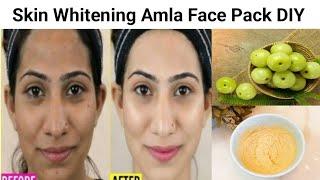 Skin Whitening Amla Face Pack to get Fair Spotless Glowing  Skin | How to make Amla Face Pack