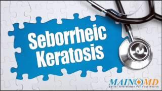 Seborrheic Keratosis ¦ Treatment and Symptoms