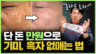 '이거'면 끝입니다! 병원가서 헛 돈 날리지 마세요! 10년 차 의사가 알려주는 기미, 흑자 홈케어 방법