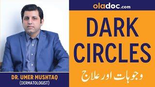 The Causes of Dark Circles Ki Wujuhaat In Urdu/Hindi | Dark Circles Treatment | Dark Eye Circles