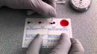 Blood Typing Using EldonCard (HD)