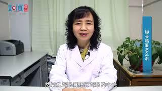 【皮肤科】脚长鸡眼怎么治