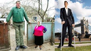 The TALLEST PEOPLE In The World