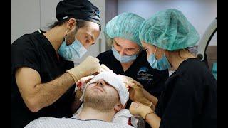 HAIRMEDIC Informationsfilm FUE-Haartransplantation