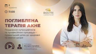 Поглиблена терапія акне