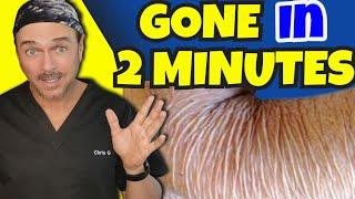 2 Minute Fix For Crepey Skin That Actually Works! | Chris Gibson