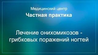 Лечение онихомикозов - грибковых поражений ногтей