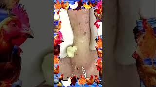 Blackheads Removal | Acne Treatment and Very Satisfying Satisfying Pimple pop #blackheads