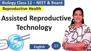 Assisted Reproductive Technology | NCERT Class 12 Biology