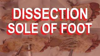 Dissection: Sole of Foot (all four layers)