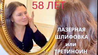 ЛАЗЕРНАЯ ШЛИФОВКА  ИЛИ ТРЕТИНОИН, ЧТО ЭФФЕКТИВНЕЕ ?