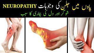 Burning feet at night | Paon me jalan ki wajah| Peripheral neuropathy kya hai