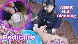 ASMR Home Made Pedicure | Nail Cleaning at Home | Deep Nail Cutting | Pedicure by Indian Lady