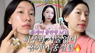 홈케어 끝판왕 MTS, 비싼 피부과 시술없이 집에서 1만원대 홈케어 하기아픈니들말고 쉽게 사용할 수있는 홈케어템