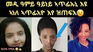 ወዲ ዓሞይ ዓይነይ ኣጥፊኡኒ እዩ ኣነውን ኣጥፊአዮ እየ ዝጠፍእ prank video 3 August 2024