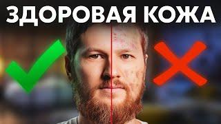 Как избавиться от ПРЫЩЕЙ? Здоровая кожа