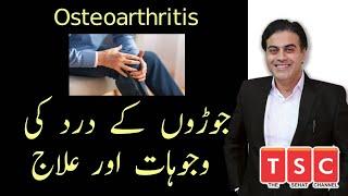 Osteoarthritis Treatment | Joron Ke Dard Ka Ilaj | its Treatment by Adeel mansoor Urdu|Hindi