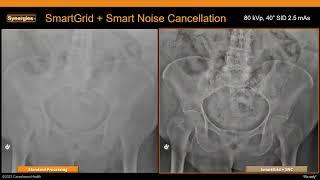 AI in Action in Radiology—Taking Imaging Process to New Heights