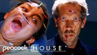 Hallucinating Disaster | House M.D..