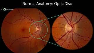 Fundus Photography Interpretation