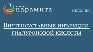 Внутрисуставные инъекции гиалуроновой кислоты