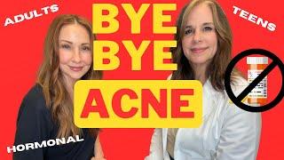 BYE BYE ACNE: Adult, Hormonal, even Teens