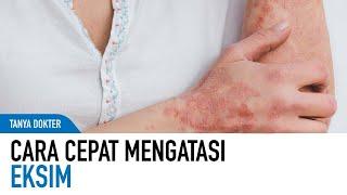 Cara Cepat dan Tepat Mengatasi Eksim di Rumah | Kata Dokter