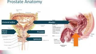 Prostate Cancer - Diagnosis and Treatment