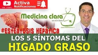 ¿Cómo puedes saber que tienes el hígado graso? Los 5 síntomas | Medicina Clara con el Dr. Bueno