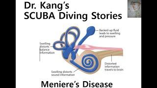 Dr. Kang's SCUBA Diving Stories - Meniere's disease and diving