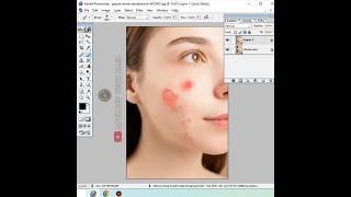 Pimple Remove Photoshop 7.0 New Trick  #shorts #short #new #trending #advancetechraja