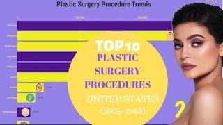 Top 10 Plastic Surgeries in US Trends (2005-2018)