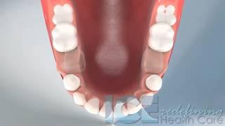 Dental Development (Lower Occlusal View)