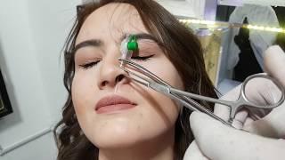 Nose | Burun | Hızma  Piercing Delimi