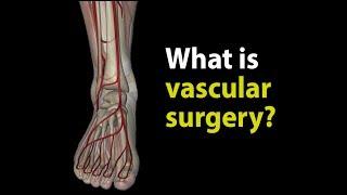 What is vascular surgery?