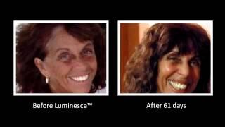 JEUNESSE ОТЗЫВЫ! Косметика JEUNESSE отзывы,результаты!